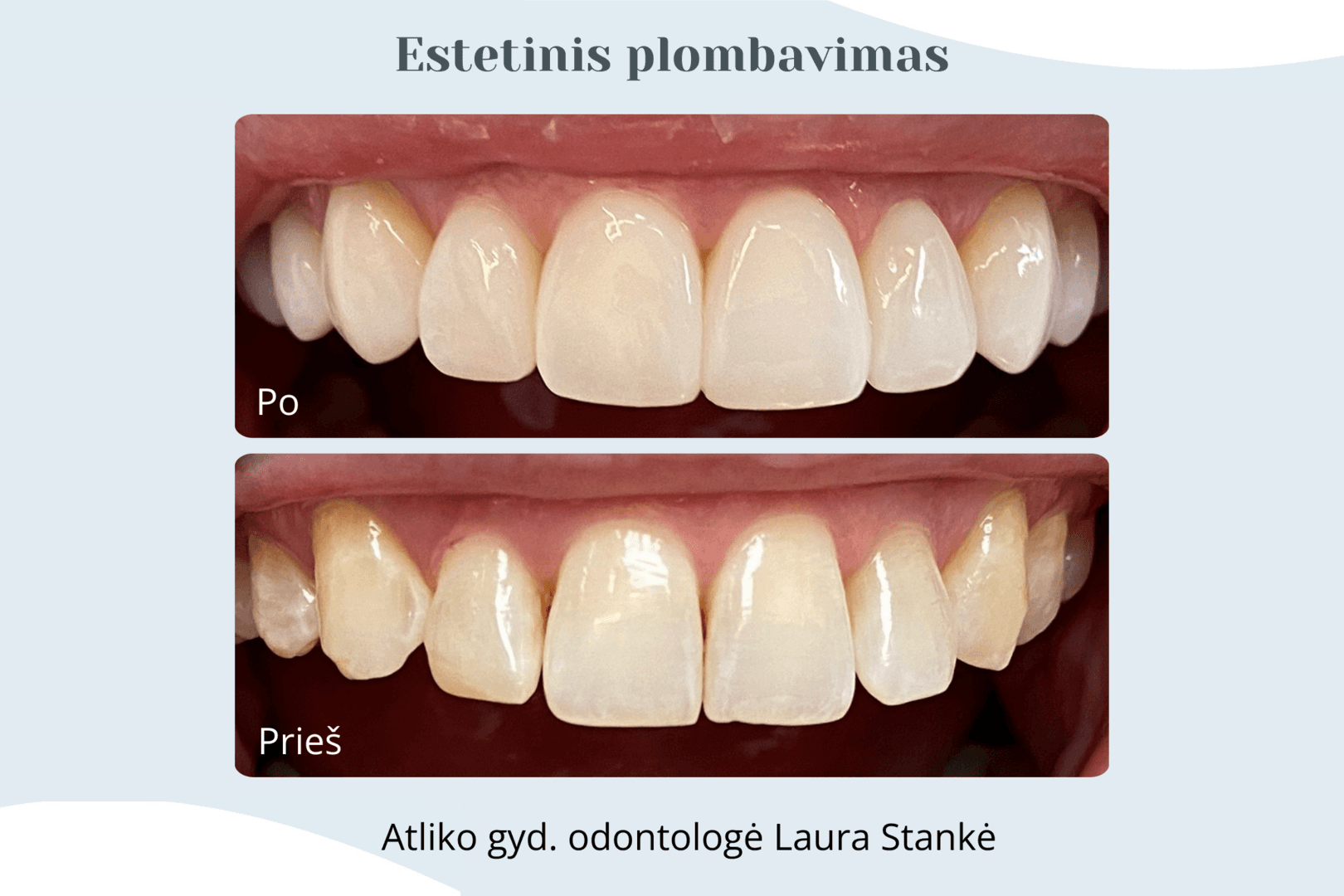 Darbo rezultatas 1