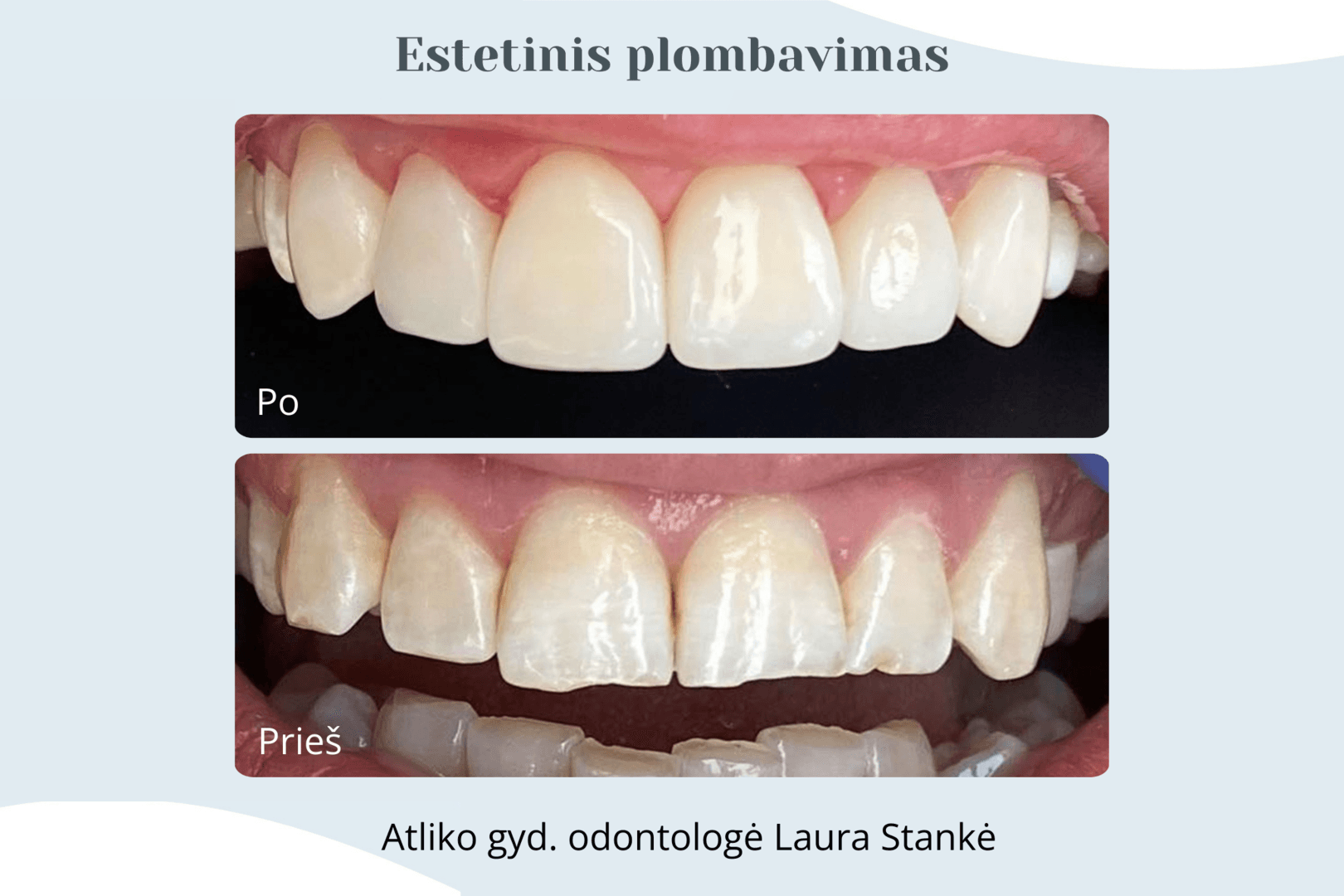 Darbo rezultatas 10