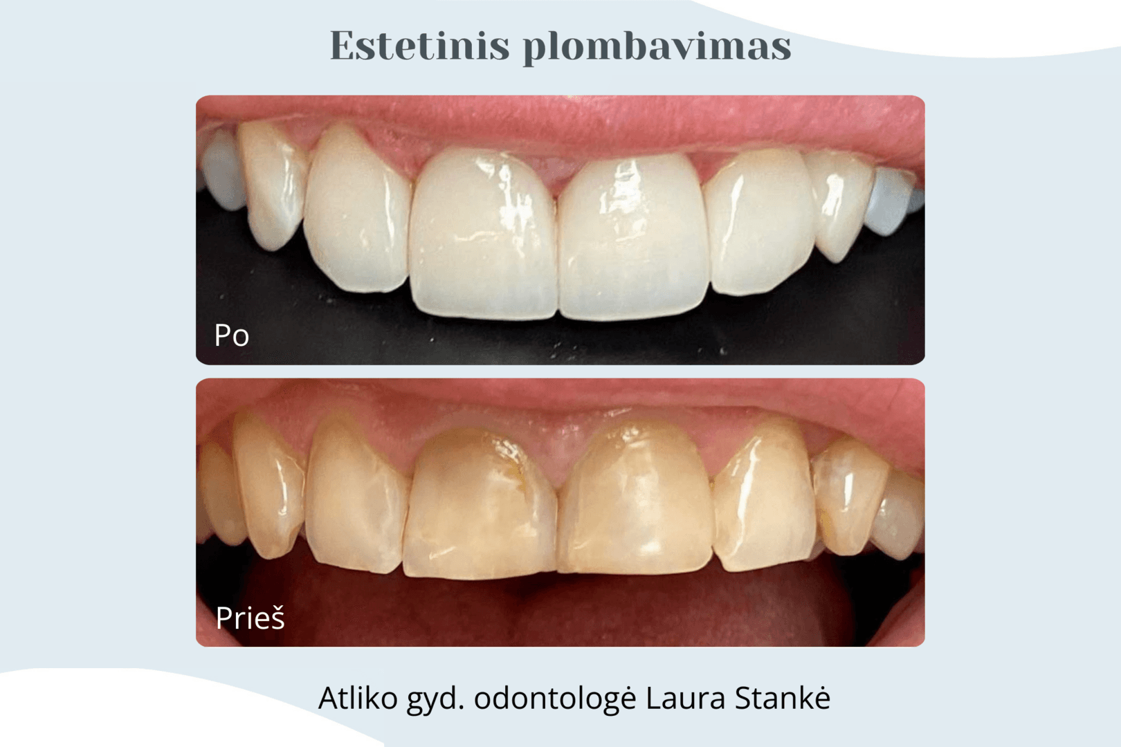 Darbo rezultatas 11