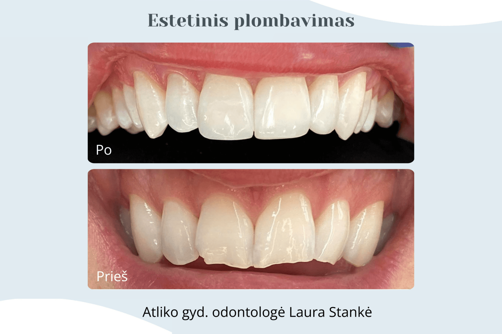 Darbo rezultatas 12