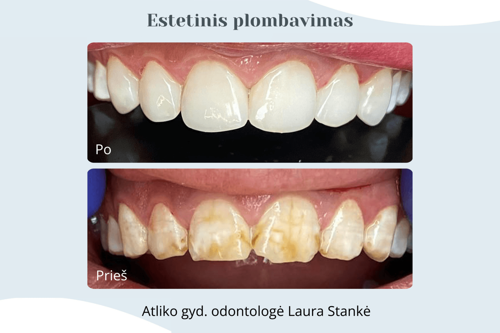 Darbo rezultatas 13