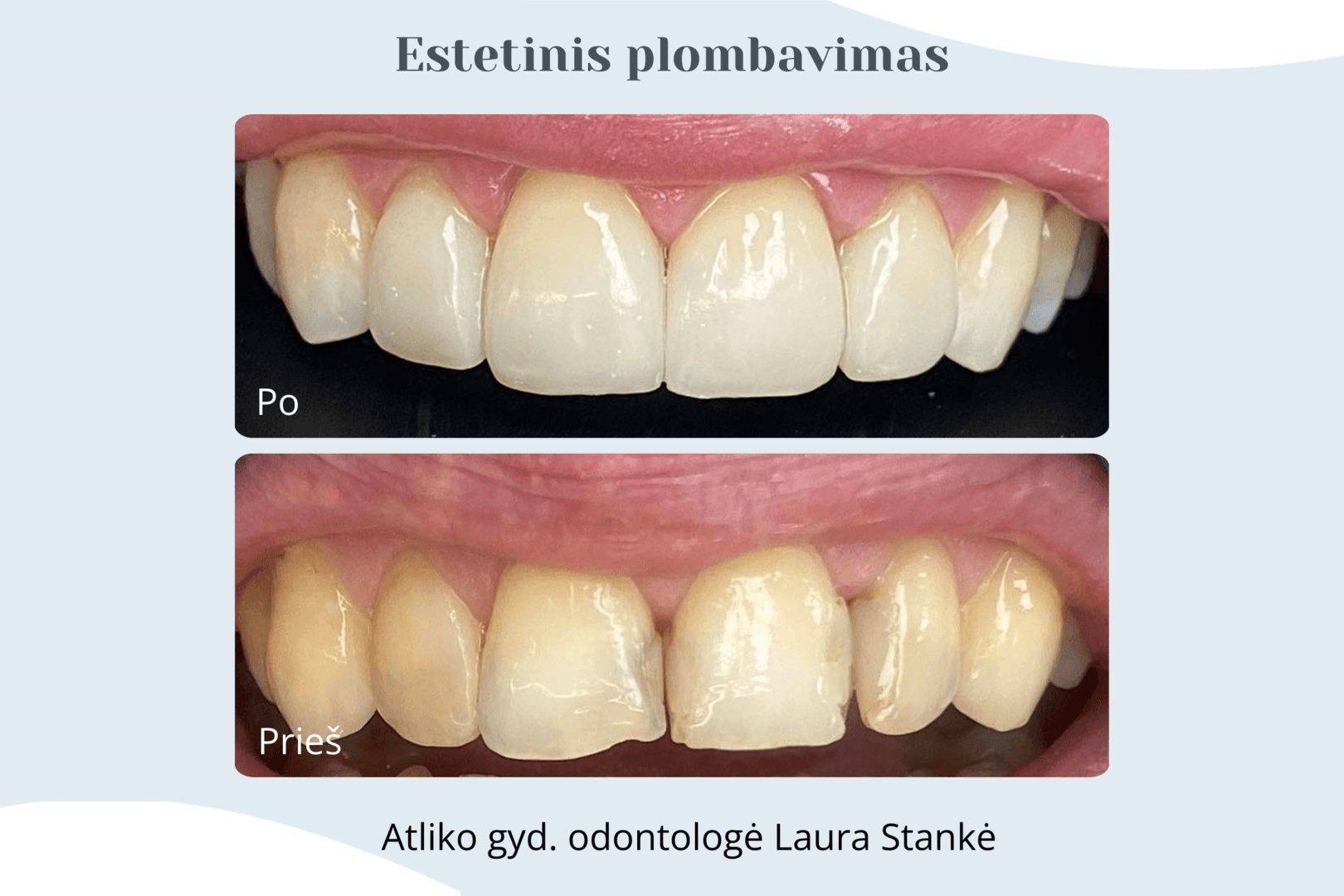 Darbo rezultatas 14