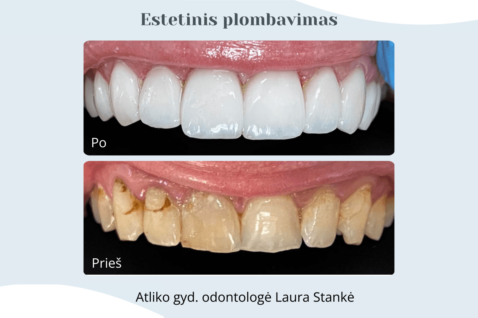 Darbo rezultatas 15
