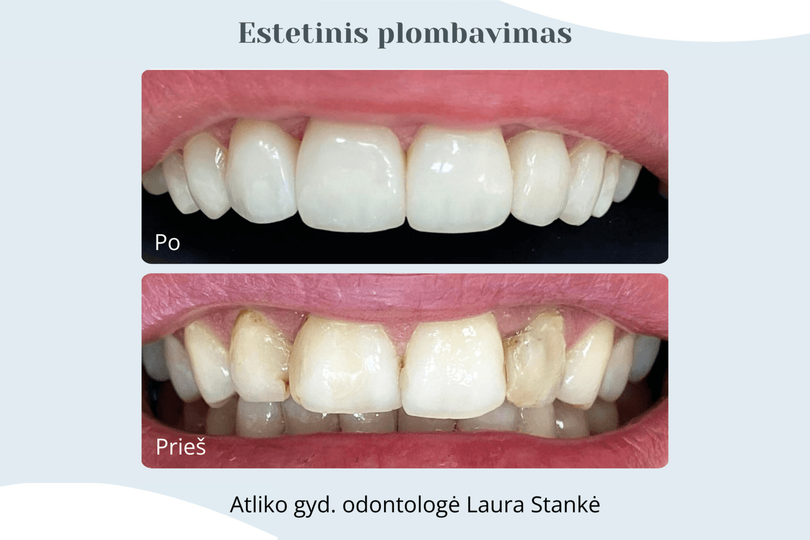 Darbo rezultatas 16