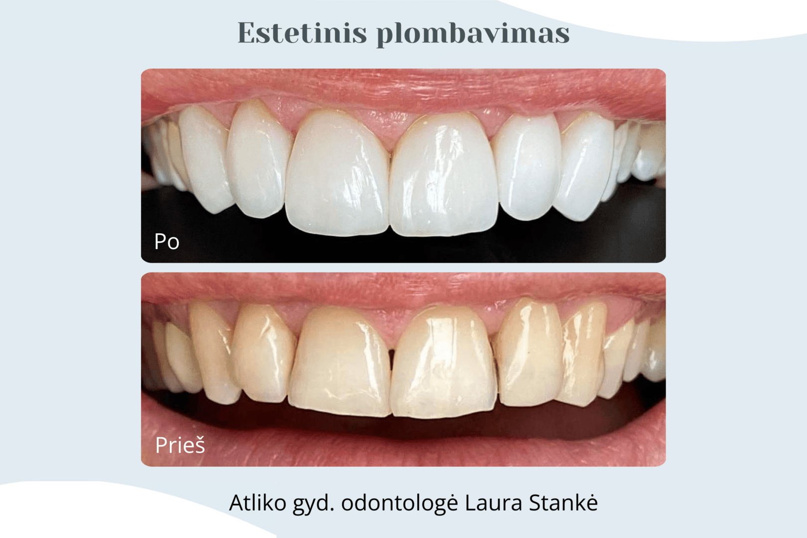 Darbo rezultatas 17
