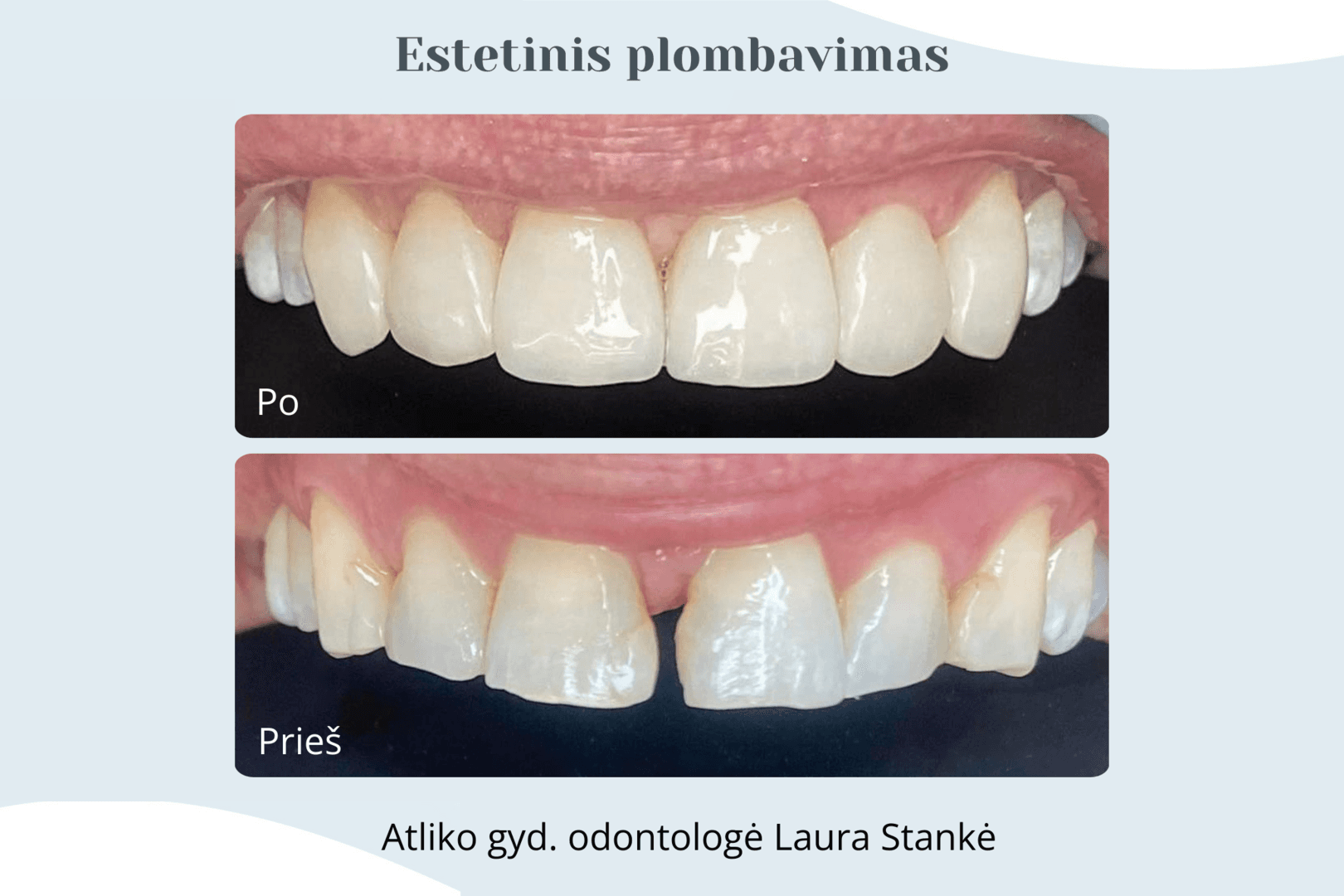 Darbo rezultatas 18