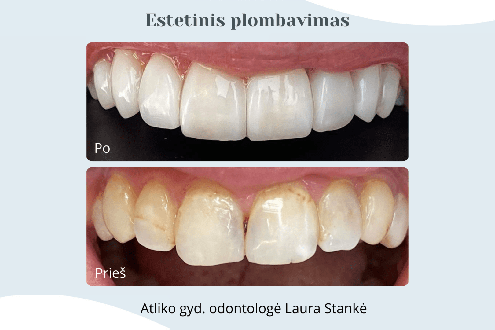 Darbo rezultatas 2