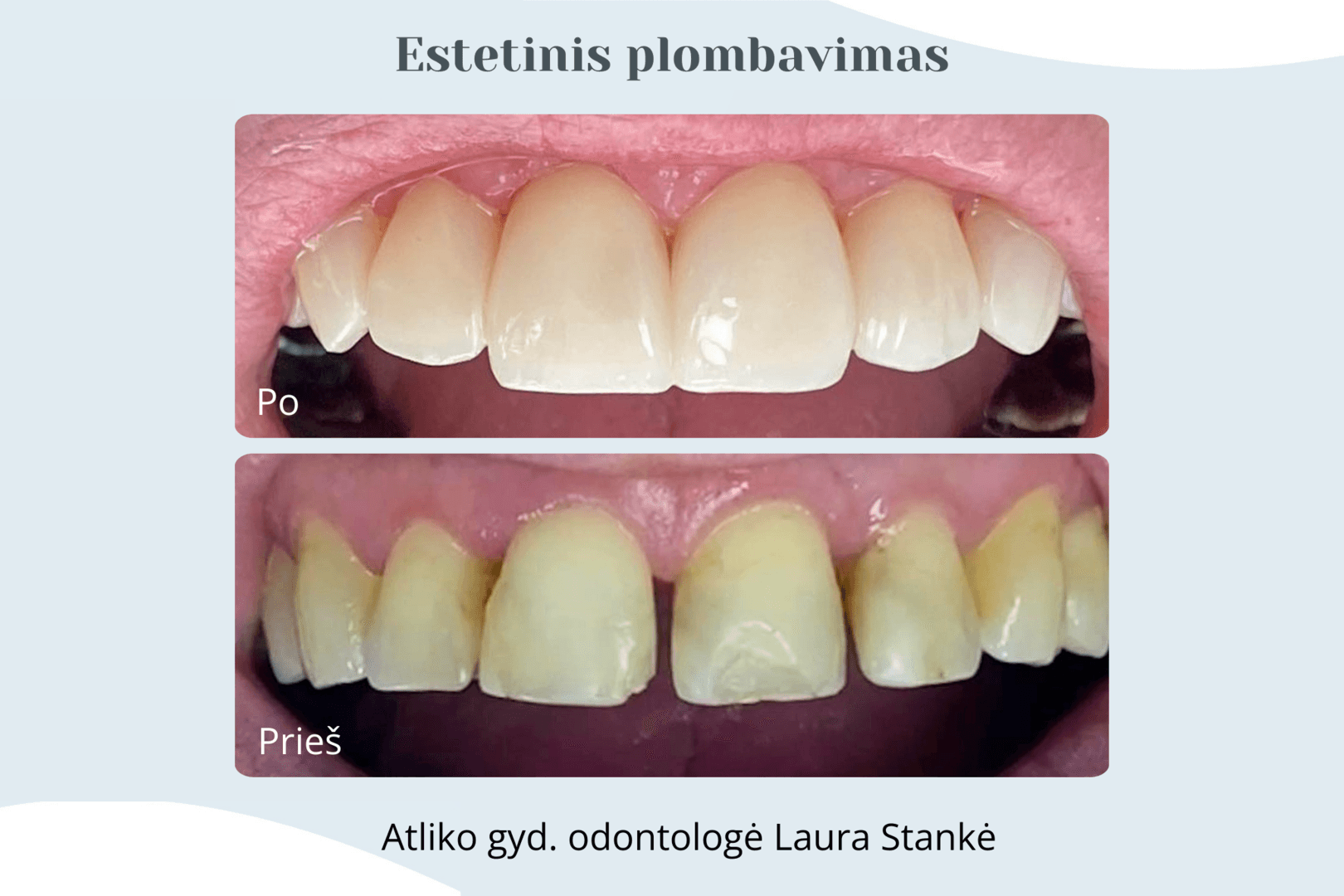 Darbo rezultatas 20