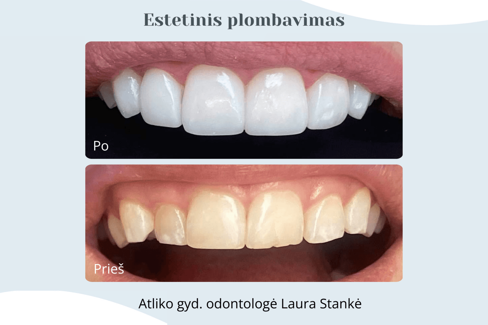 Darbo rezultatas 3
