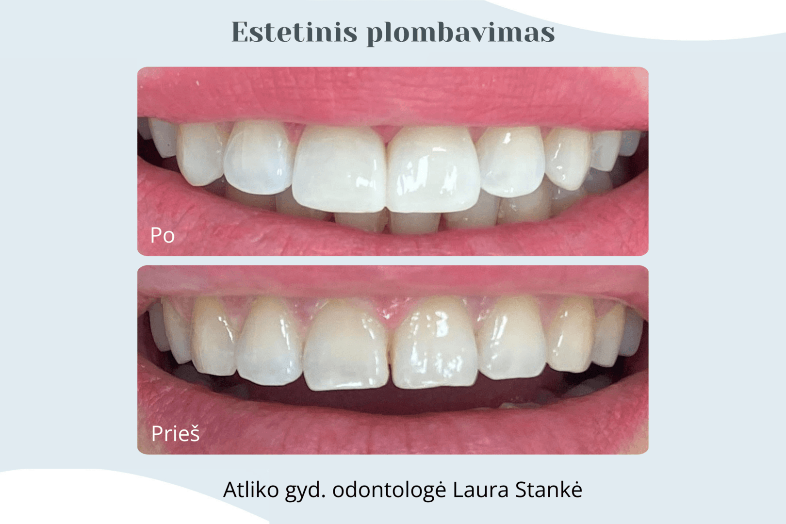 Darbo rezultatas 4