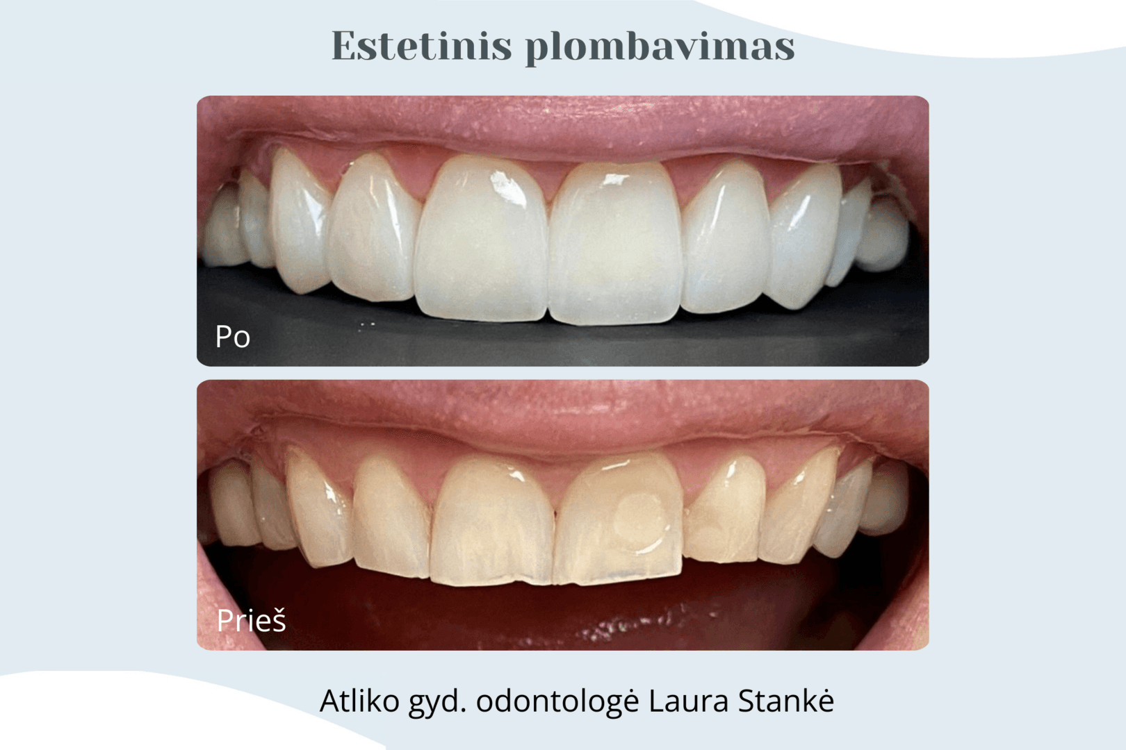 Darbo rezultatas 5