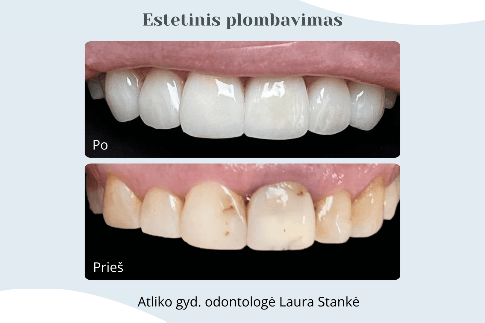 Darbo rezultatas 6